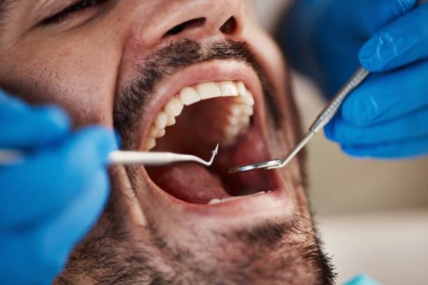 Best Emergency Dental Care for Broken or Chipped Teeth in Hollidaysburg, PA